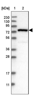 Lane 1: Marker [kDa] 230, 130, 95, 72, 56, 36, 28, 17, 11_br/_Lane 2: Human cell line RT-4
