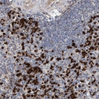 Anti-MMP8 Antibody