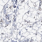 Anti-PTRH1 Antibody
