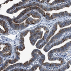Immunohistochemical staining of human fallopian tube shows strong cytoplasmic positivity in glandular cells.