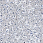 Immunohistochemical staining of human liver shows no cytoplasmic positivity in hepatocytes as expected.