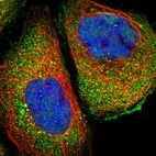 Immunofluorescent staining of human cell line A-431 shows localization to cytosol.
