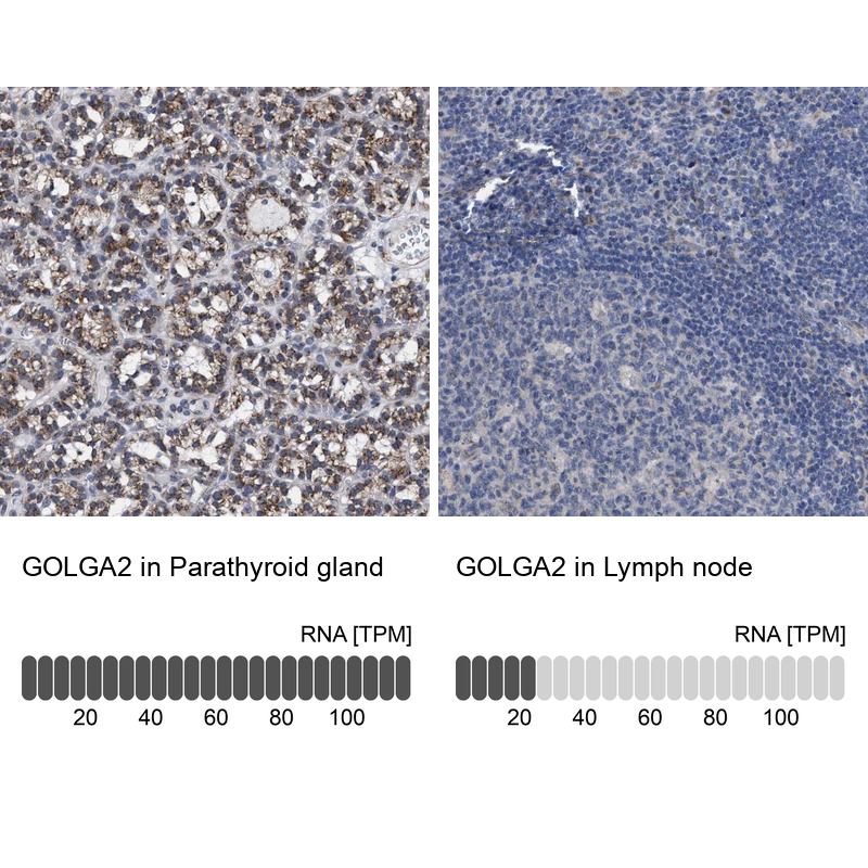 Anti-GOLGA2 Antibody