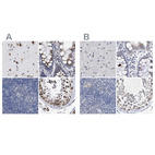 Immunohistochemical staining of human cerebral cortex, colon, lymph node and testis using Anti-GOLGA2 antibody HPA021230 (A) shows similar protein distribution across tissues to independent antibody HPA021178 (B).