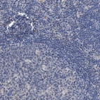 Immunohistochemical staining of human lymph node shows low expression as expected.