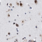 Immunohistochemical staining of human cerebral cortex using Anti-GOLGA2 antibody HPA021230.