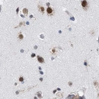 Immunohistochemical staining of human cerebral cortex using Anti-GOLGA2 antibody HPA021230.