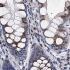 Immunohistochemical staining of human colon using Anti-GOLGA2 antibody HPA021230.