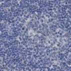 Anti-GOLGA2 Antibody