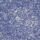 Immunohistochemical staining of human lymph node using Anti-GOLGA2 antibody HPA021230.