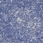 Immunohistochemical staining of human lymph node using Anti-GOLGA2 antibody HPA021230.