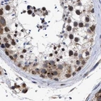 Immunohistochemical staining of human testis using Anti-GOLGA2 antibody HPA021230.