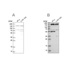 Western blot analysis using Anti-GOLGA2 antibody HPA021230 (A) shows similar pattern to independent antibody HPA021178 (B).