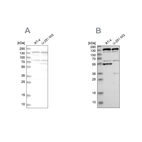 Western blot analysis using Anti-GOLGA2 antibody HPA021230 (A) shows similar pattern to independent antibody HPA021178 (B).