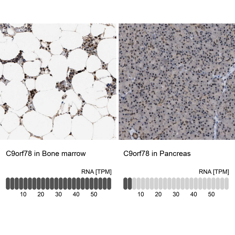 Anti-C9orf78 Antibody