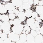 Immunohistochemical staining of human bone marrow shows high expression.