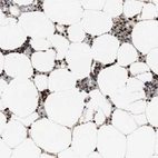 Immunohistochemical staining of human bone marrow shows high expression.
