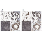 Immunohistochemical staining of human bone marrow, fallopian tube, lymph node and testis using Anti-C9orf78 antibody HPA021232 (A) shows similar protein distribution across tissues to independent antibody HPA021216 (B).