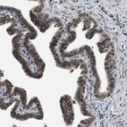 Immunohistochemical staining of human Fallopian tube shows moderate nuclear positivity in glandular cells.