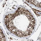 Immunohistochemical staining of human testis shows strong nuclear positivity in cells in seminiferous ducts.