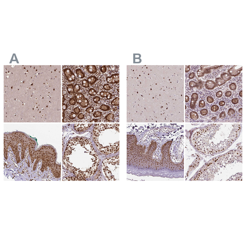 Anti-NACC1 Antibody