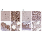 Anti-NACC1 Antibody
