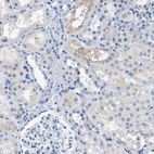 Anti-KIFC3 Antibody