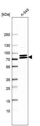 Anti-KIFC3 Antibody