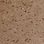 Immunohistochemical staining of human cerebral cortex shows moderate to strong cytoplasmic positivity in neuronal and glial cells.