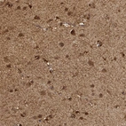 Immunohistochemical staining of human cerebral cortex shows moderate to strong cytoplasmic positivity in neuronal and glial cells.