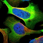 Immunofluorescent staining of human cell line U-2 OS shows localization to plasma membrane & cytosol.
