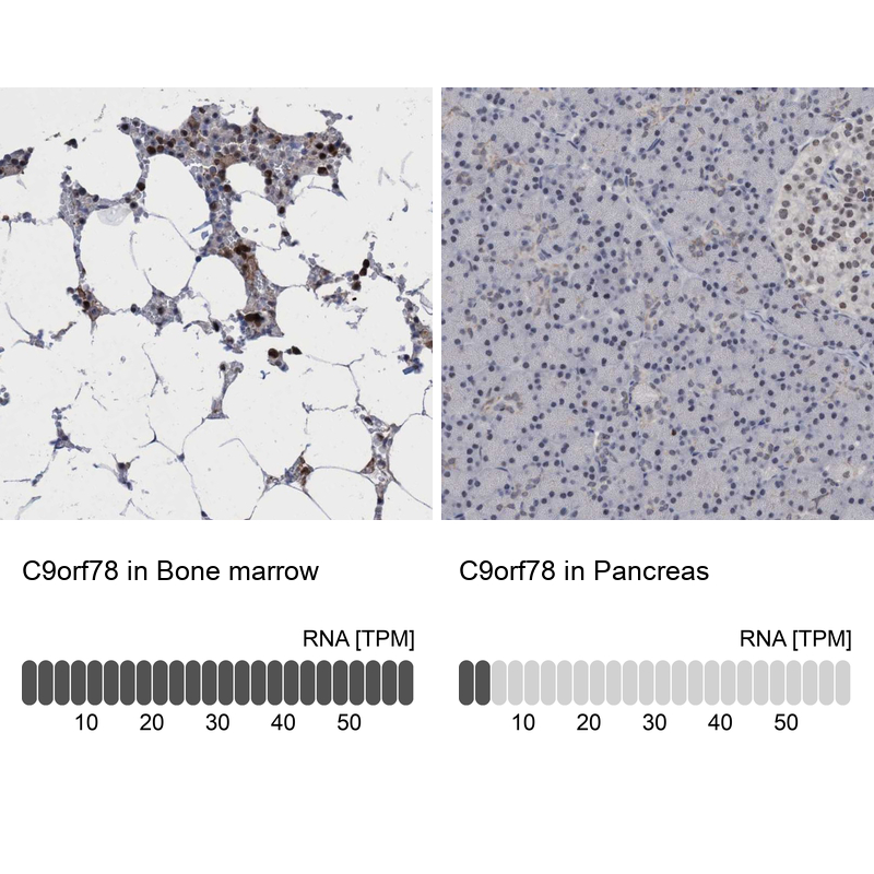 Anti-C9orf78 Antibody