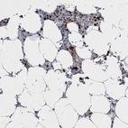 Immunohistochemical staining of human bone marrow shows high expression.