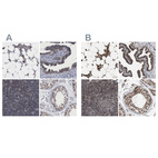 Immunohistochemical staining of human bone marrow, fallopian tube, lymph node and testis using Anti-C9orf78 antibody HPA021242 (A) shows similar protein distribution across tissues to independent antibody HPA021216 (B).