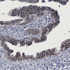 Immunohistochemical staining of human Fallopian tube shows moderate nuclear positivity in glandular cells.