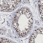 Immunohistochemical staining of human testis shows strong nuclear positivity in cells in seminiferous ducts.