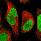 Immunofluorescent staining of human cell line U-2 OS shows localization to nucleoplasm.