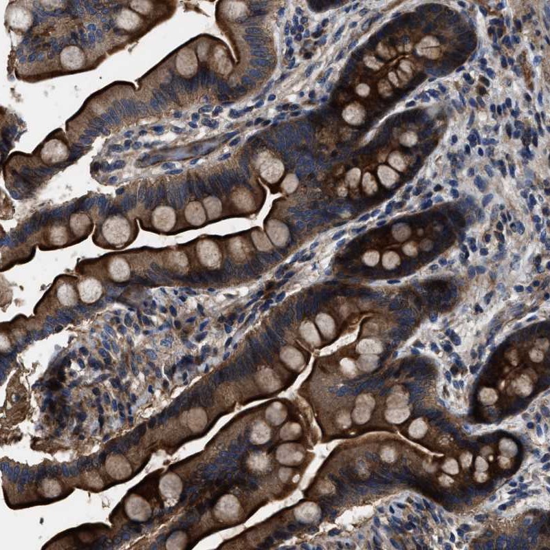 Anti-PTAR1 Antibody