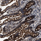 Anti-PTAR1 Antibody
