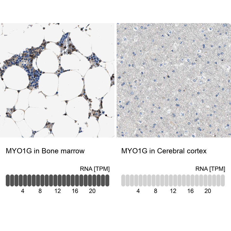 Anti-MYO1G Antibody