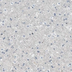 Immunohistochemical staining of human cerebral cortex shows low expression as expected.