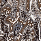 Anti-BAIAP2L1 Antibody