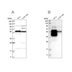 Western blot analysis using Anti-BAIAP2L1 antibody HPA021257 (A) shows similar pattern to independent antibody HPA019484 (B).