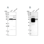 Western blot analysis using Anti-BAIAP2L1 antibody HPA021257 (A) shows similar pattern to independent antibody HPA019484 (B).