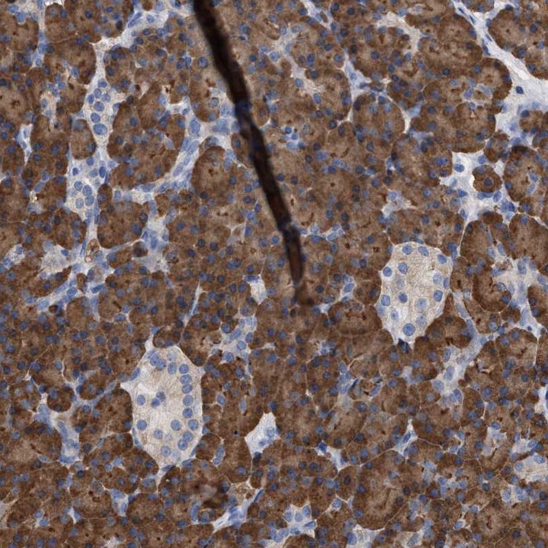 Anti-ERCC6L2 Antibody