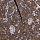 Anti-ERCC6L2 Antibody