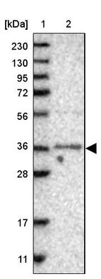 Lane 1: Marker [kDa] 230, 130, 95, 72, 56, 36, 28, 17, 11_br/_Lane 2: Human cell line RT-4