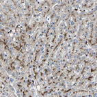 Anti-DPP7 Antibody