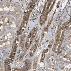 Anti-DPP7 Antibody