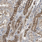 Immunohistochemical staining of human kidney shows strong cytoplasmic granular positivity in cells in tubules.